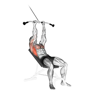Cable Incline Pushdown